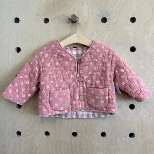 Pink Quilted Reversible Jacket